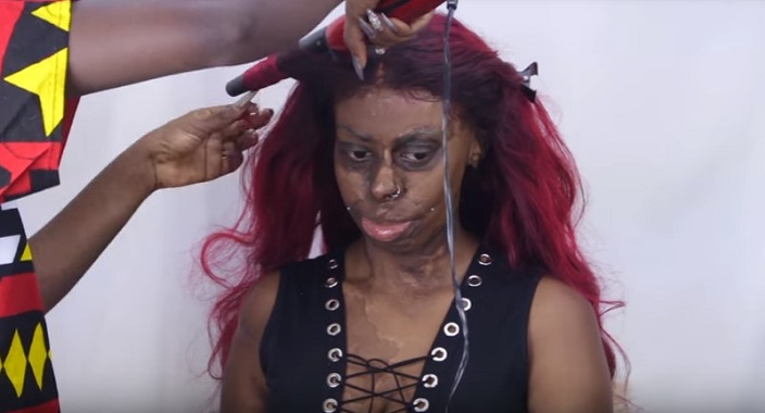 Burn Survivor Makeup Transformation