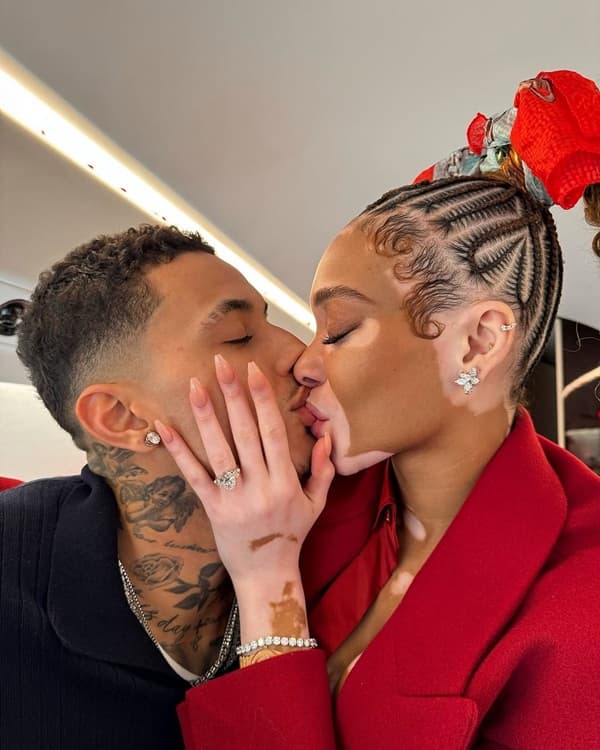 Model Winnie Harlow Is Engaged to Her Boyfriend Kyle Kuzma: See Her Engagement Ring