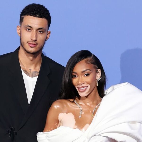 Model Winnie Harlow Is Engaged to Her…