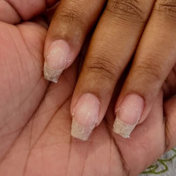 Up close photo showing nail breakage - Fashion Police Nigeria