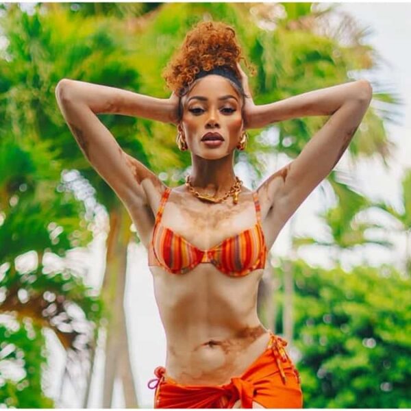 Winnie Harlow Showcases Her Supermodel Figure in a Bright Thong Bikini