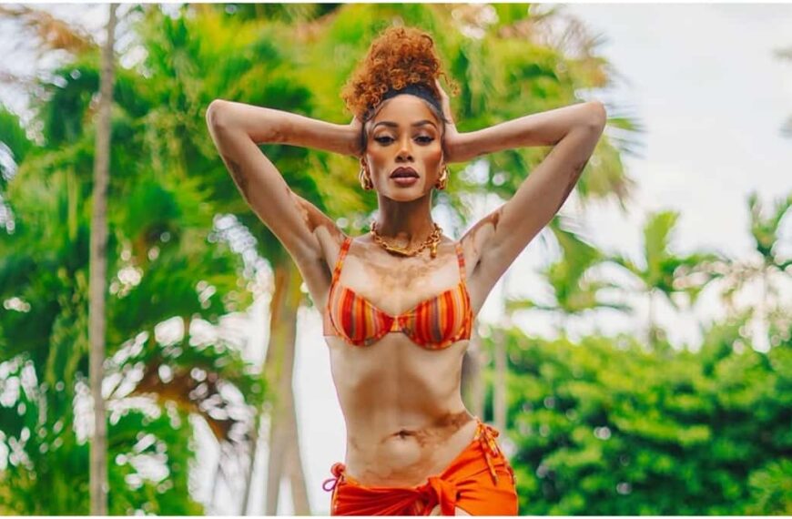 Winnie Harlow Showcases Her Supermodel Figure in a Bright Thong Bikini