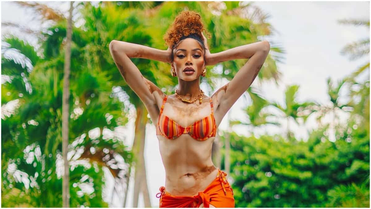 Winnie Harlow Showcases Her Supermodel Figure in a&hellip;