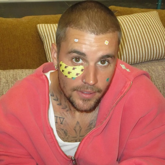 justin bieber on rhode pimple patches (2)