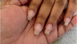 What You Need to Know About Nail Breakage: Causes and Solutions