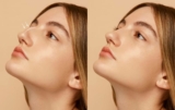 3 Tips And Tricks For Negotiating The Best Price For Your Rhinoplasty Procedure